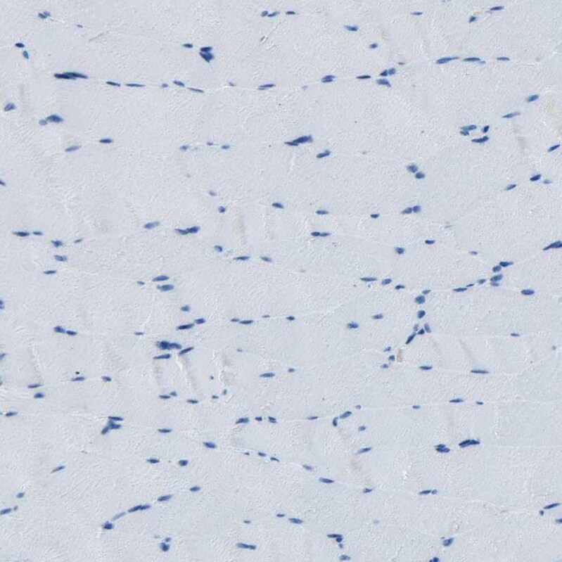 Fibrillin 2 Antibody - BSA Free Immunohistochemistry-Paraffin: Fibrillin 2 Antibody - BSA Free [NBP1-88169]