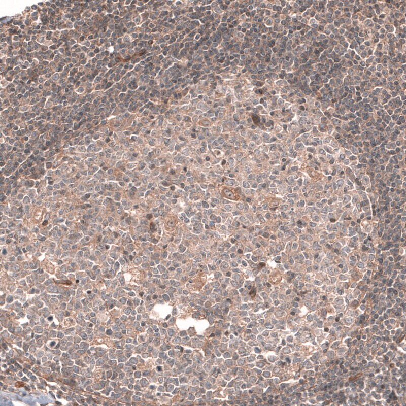 Cav3.2 Antibody - BSA Free Immunohistochemistry-Paraffin: Cav3.2 Antibody [NBP1-88176]
