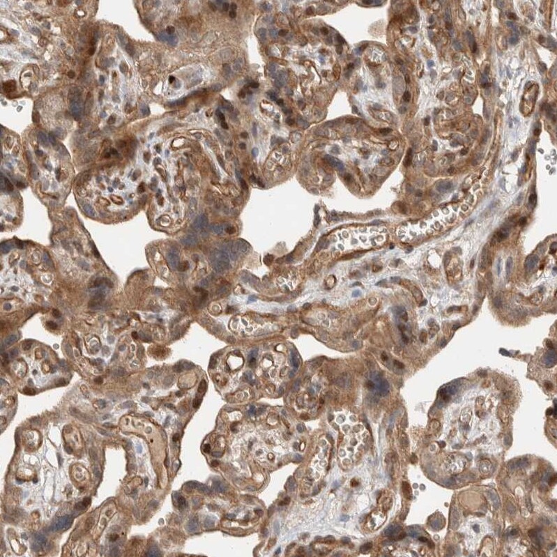 ELKS Antibody - BSA Free Immunohistochemistry-Paraffin: ELKS Antibody - BSA Free [NBP1-88177]