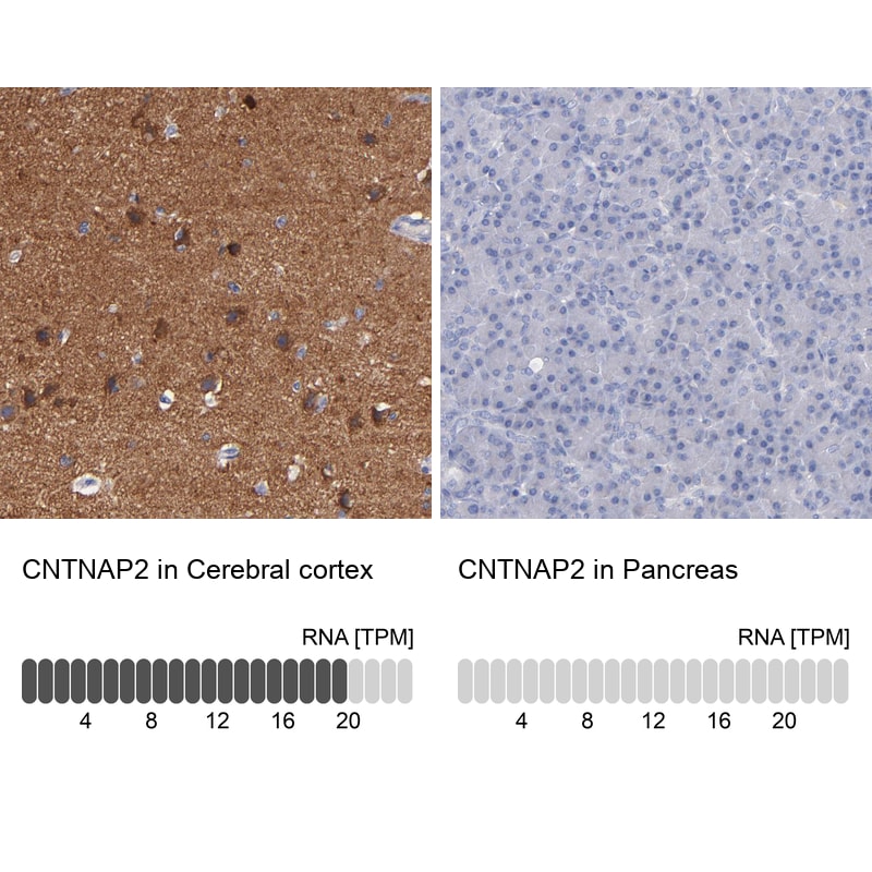 Caspr2 Antibody - BSA Free Immunohistochemistry-Paraffin: Caspr2 Antibody - BSA Free [NBP1-88182]