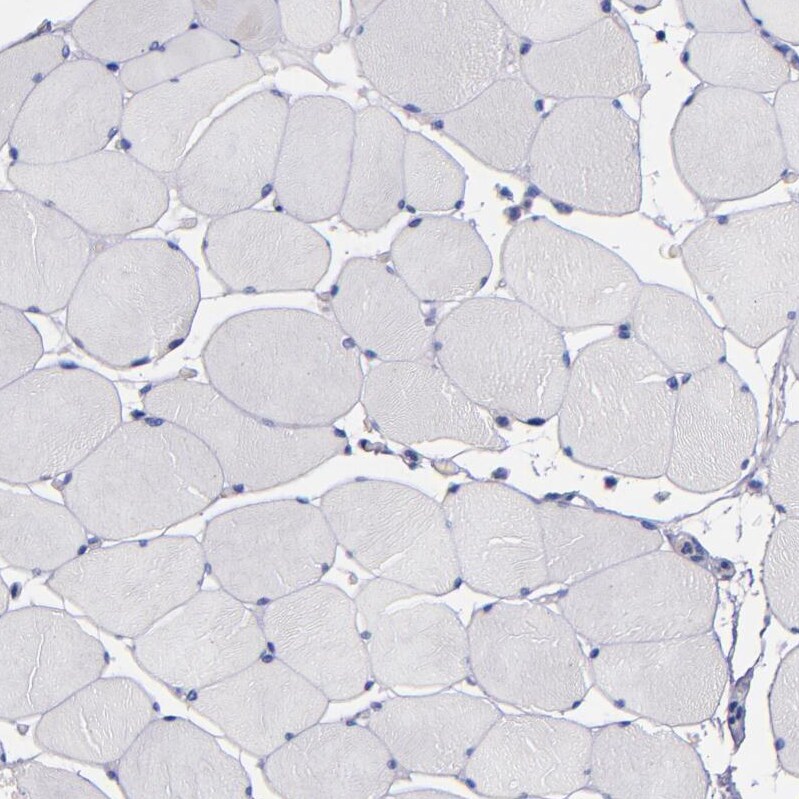 Caspr2 Antibody - BSA Free Immunohistochemistry-Paraffin: Caspr2 Antibody - BSA Free [NBP1-88182]