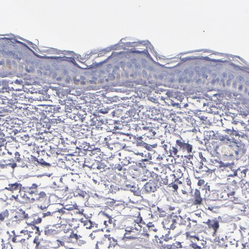 Caspr2 Antibody - BSA Free Immunohistochemistry-Paraffin: Caspr2 Antibody - BSA Free [NBP1-88182]
