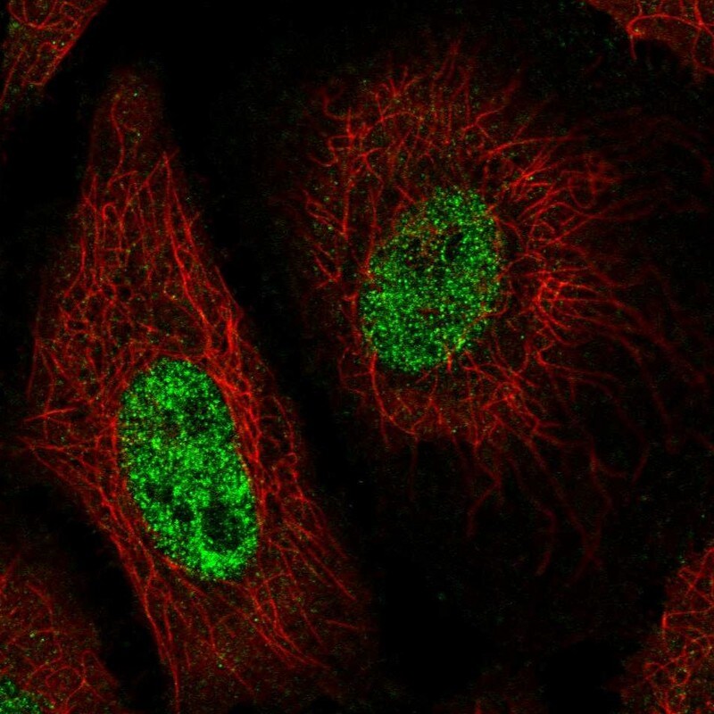 Caspr1 Antibody - BSA Free Immunocytochemistry/ Immunofluorescence: Caspr1 Antibody [NBP1-88183]
