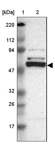 Caspase-8 Antibody - BSA Free Western Blot: Caspase-8 Antibody - BSA Free [NBP1-88184]