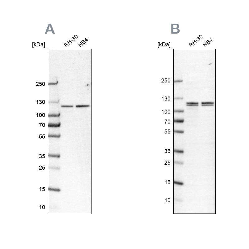GPIP137 Antibody - BSA Free Western Blot: GPIP137 Antibody - BSA Free [NBP1-88195]
