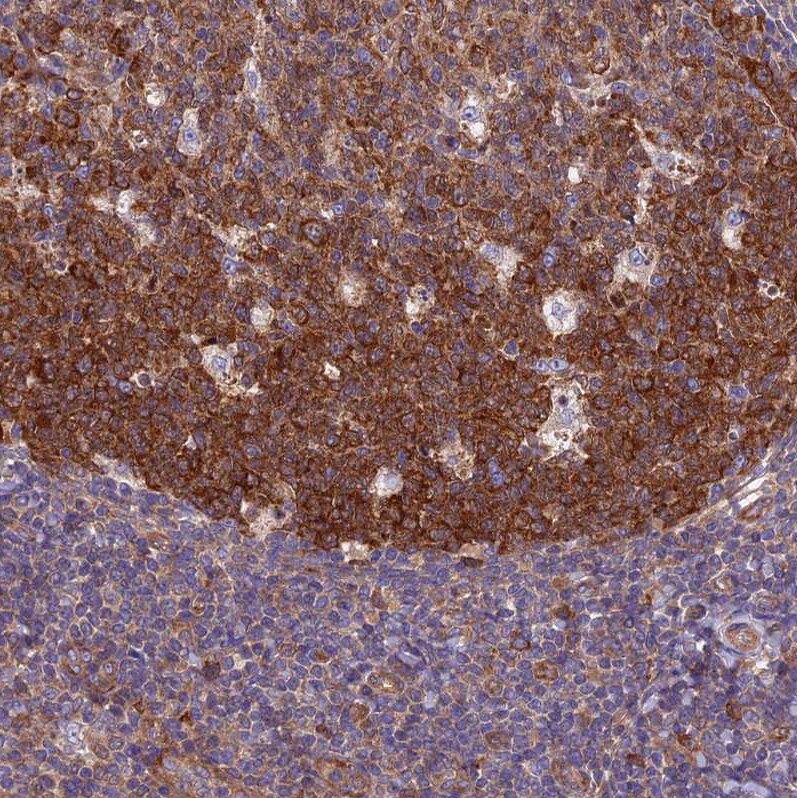 HCAP-G Antibody - BSA Free Immunohistochemistry-Paraffin: HCAP-G Antibody - BSA Free [NBP1-88199]