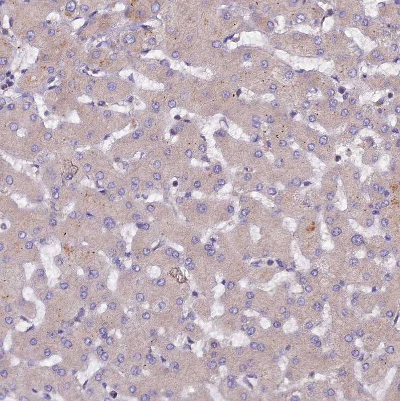 HCAP-G Antibody - BSA Free Immunohistochemistry-Paraffin: HCAP-G Antibody - BSA Free [NBP1-88199]