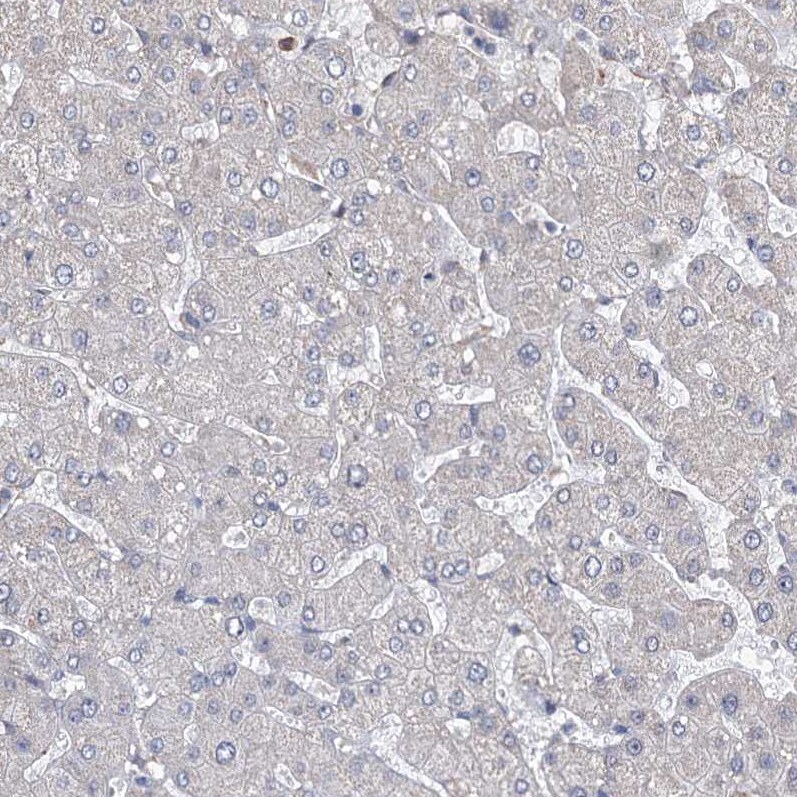 CNAP1 Antibody - BSA Free Immunohistochemistry-Paraffin: CNAP1 Antibody - BSA Free [NBP1-88202]