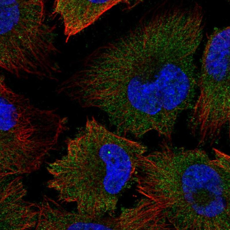 Calpain 2 Antibody - BSA Free Immunocytochemistry/ Immunofluorescence: Calpain 2 Antibody [NBP1-88204]