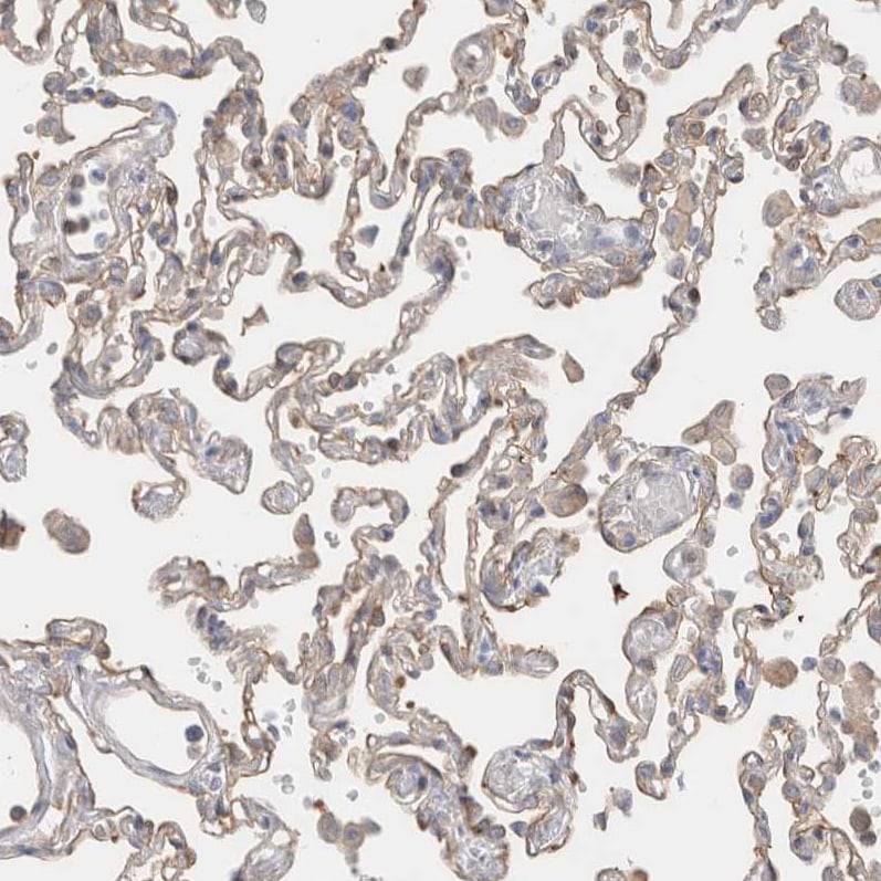 Calpain 2 Antibody - BSA Free Immunohistochemistry-Paraffin: Calpain 2 Antibody - BSA Free [NBP1-88204]