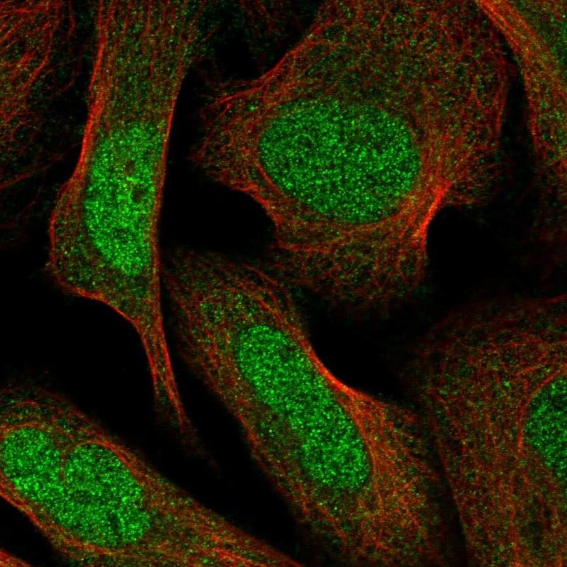 Protein phosphatase 1F Antibody - BSA Free Immunocytochemistry/ Immunofluorescence: Protein phosphatase 1F Antibody - BSA Free [NBP1-88207]