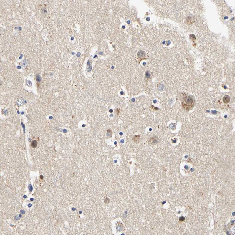 CaMKIV Antibody - BSA Free Immunohistochemistry-Paraffin: CaMKIV Antibody - BSA Free [NBP1-88210]