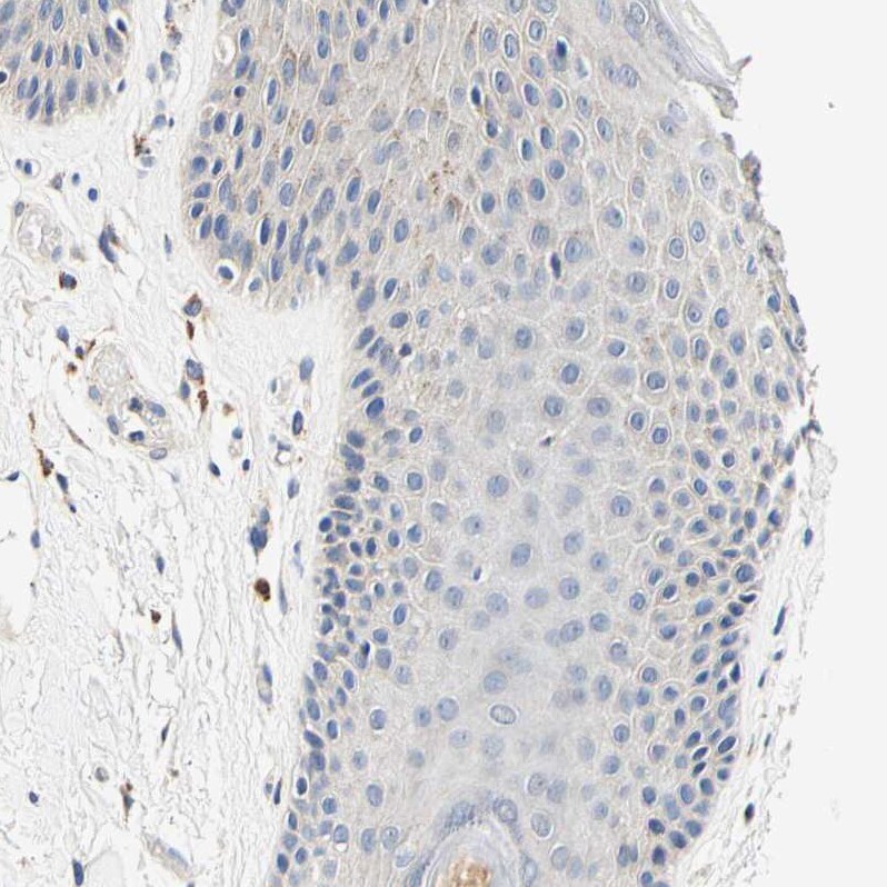 CaMKIV Antibody - BSA Free Immunohistochemistry-Paraffin: CaMKIV Antibody - BSA Free [NBP1-88210]