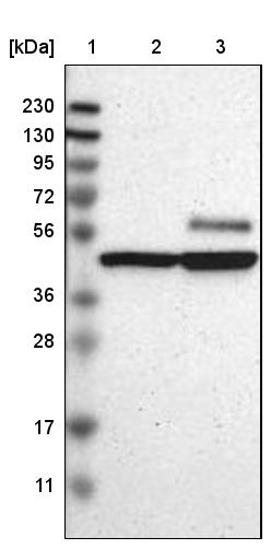 CaMKIV Antibody - BSA Free Western Blot: CaMKIV Antibody - BSA Free [NBP1-88210]