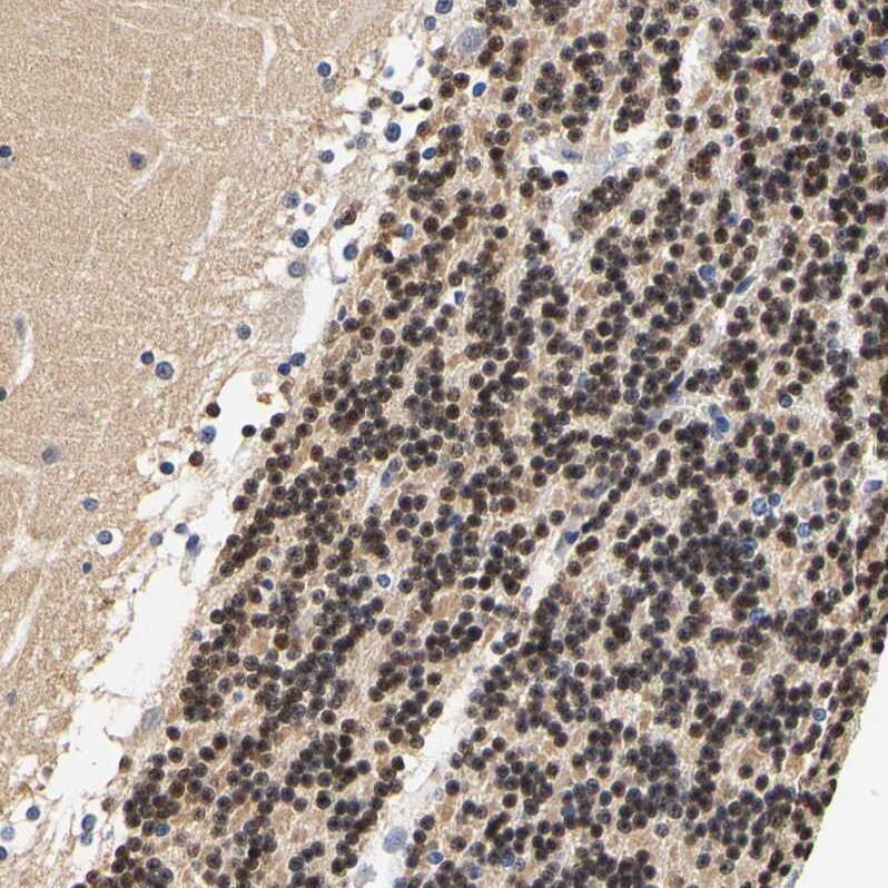 CaMKIV Antibody - BSA Free Immunohistochemistry-Paraffin: CaMKIV Antibody - BSA Free [NBP1-88210]