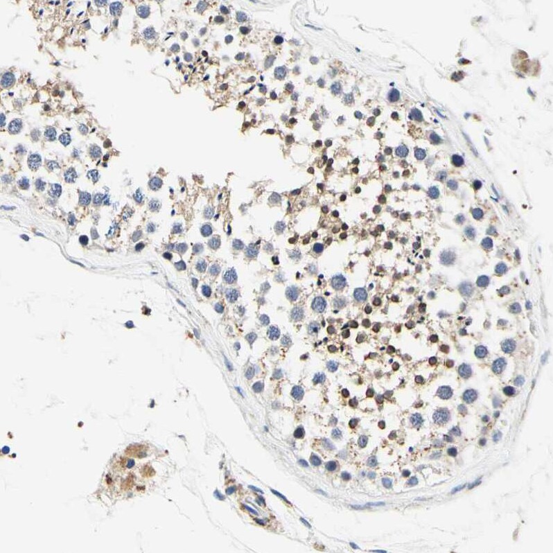 CaMKIV Antibody - BSA Free Immunohistochemistry-Paraffin: CaMKIV Antibody - BSA Free [NBP1-88210]