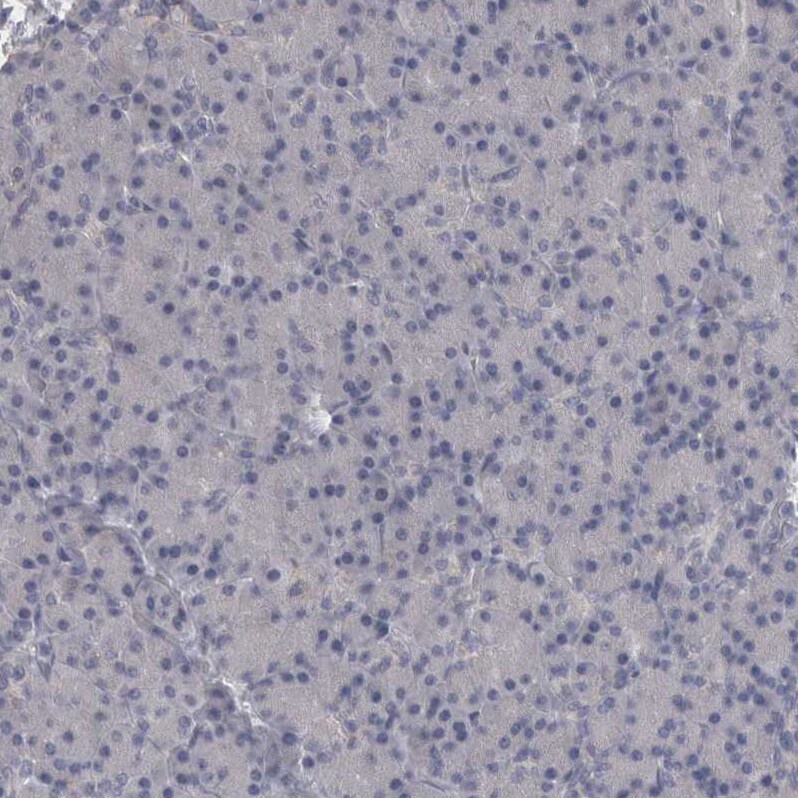 CaM Kinase II delta Antibody - BSA Free Immunohistochemistry-Paraffin: CaM Kinase II delta Antibody - BSA Free [NBP1-88211]