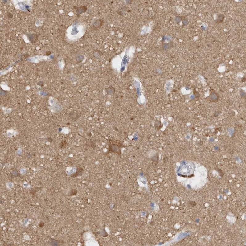 CaM Kinase II delta Antibody - BSA Free Immunohistochemistry-Paraffin: CaM Kinase II delta Antibody - BSA Free [NBP1-88211]