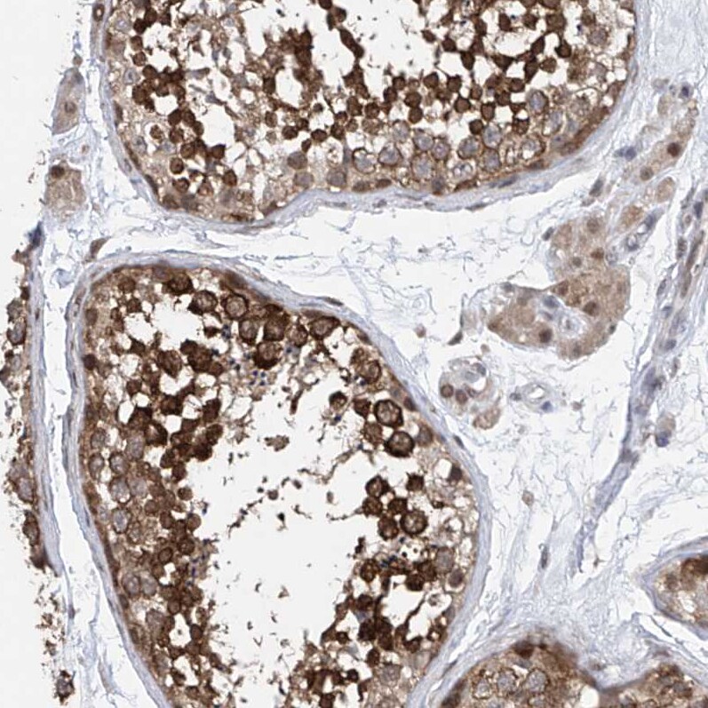 Centrin 2 Antibody Immunohistochemistry-Paraffin: Parvin gamma Antibody [NBP1-88213]