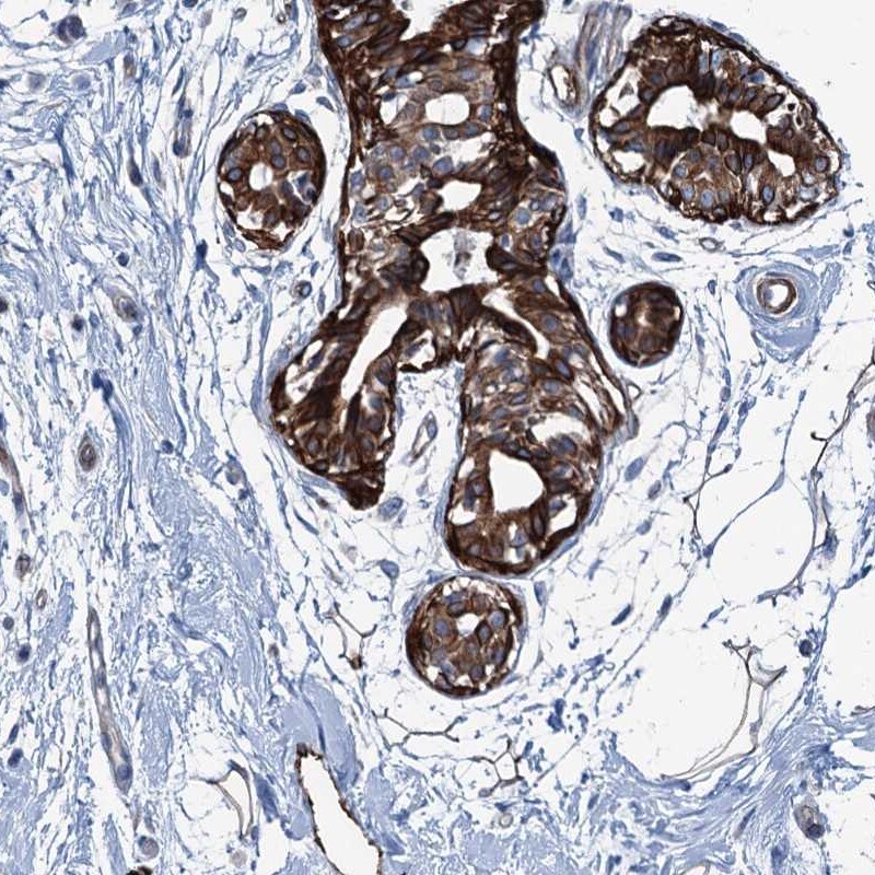 CoCoA Antibody - BSA Free Immunohistochemistry-Paraffin: CoCoA Antibody [NBP1-88215]