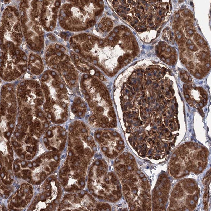 CoCoA Antibody - BSA Free Immunohistochemistry-Paraffin: CoCoA Antibody [NBP1-88216]