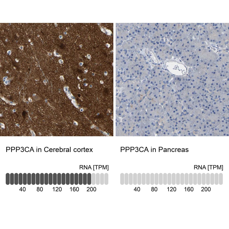 Calcineurin A Antibody - BSA Free Immunohistochemistry-Paraffin: Calcineurin A Antibody - BSA Free [NBP1-88218]