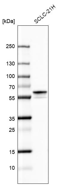 Calcineurin A Antibody - BSA Free Western Blot: Calcineurin A Antibody - BSA Free [NBP1-88218]
