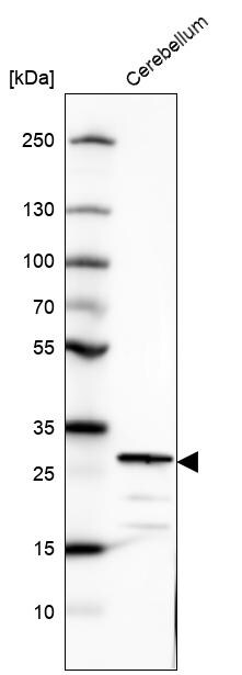 Secretagogin Antibody - BSA Free Western Blot: Secretagogin Antibody - BSA Free [NBP1-88219]