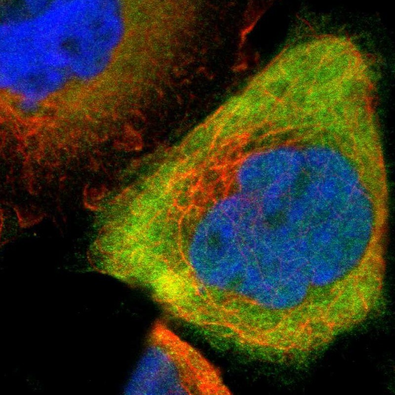 Calretinin Antibody - BSA Free Immunocytochemistry/ Immunofluorescence: Calretinin Antibody - BSA Free [NBP1-88220]