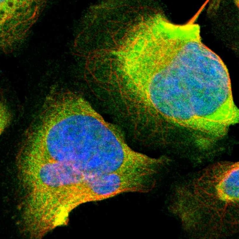 Calretinin Antibody - BSA Free Immunocytochemistry/ Immunofluorescence: Calretinin Antibody - BSA Free [NBP1-88221]