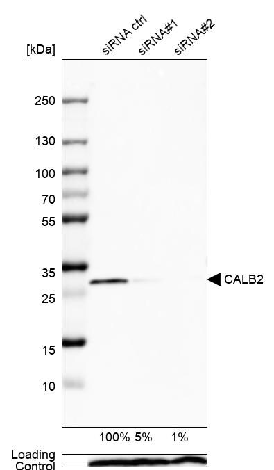 Calretinin Antibody - BSA Free Western Blot: Calretinin Antibody - BSA Free [NBP1-88221]