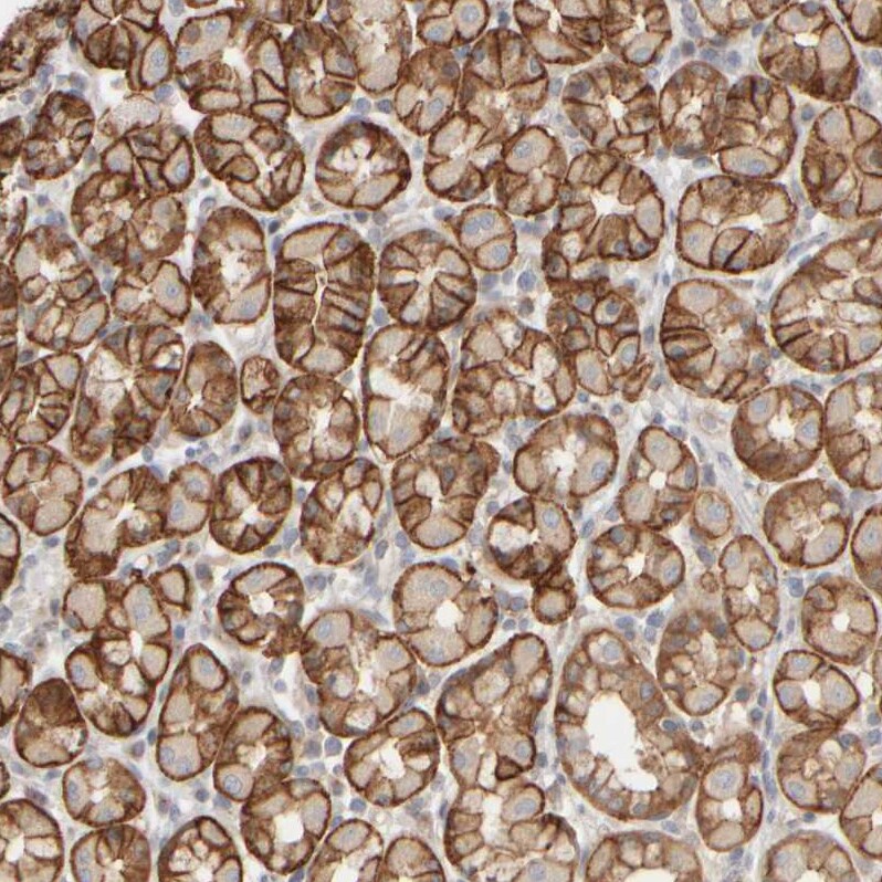 PIST Antibody - BSA Free Immunohistochemistry-Paraffin: PIST Antibody - BSA Free [NBP1-88223]