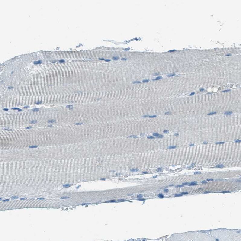 Mesothelin Antibody - BSA Free Immunohistochemistry-Paraffin: Mesothelin Antibody - BSA Free [NBP1-88224]