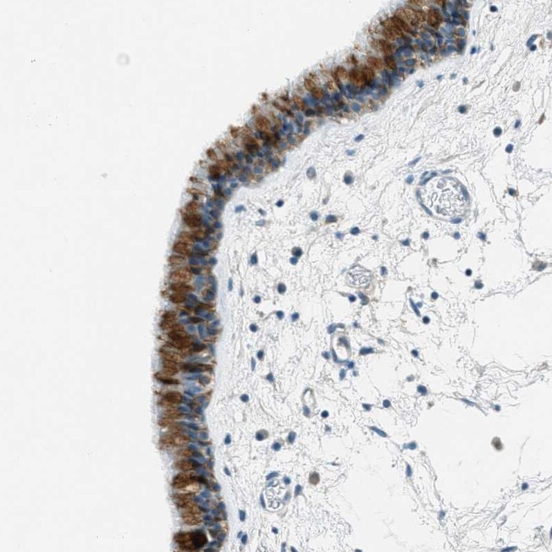 Mesothelin Antibody - BSA Free Immunohistochemistry-Paraffin: Mesothelin Antibody - BSA Free [NBP1-88224]