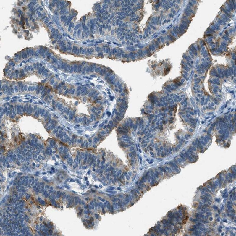 Mesothelin Antibody - BSA Free Immunohistochemistry-Paraffin: Mesothelin Antibody - BSA Free [NBP1-88224]