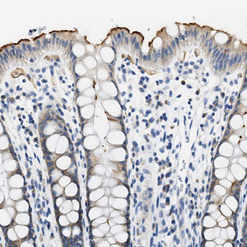 Carbonic Anhydrase IV/CA4 Antibody - BSA Free Immunohistochemistry-Paraffin: Carbonic Anhydrase IV/CA4 Antibody - BSA Free [NBP1-88225]