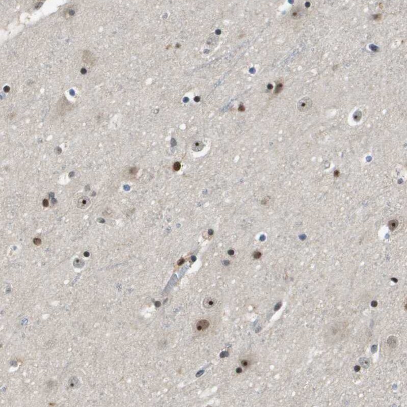 p400 Antibody - BSA Free Immunohistochemistry-Paraffin: p400 Antibody - BSA Free [NBP1-88230]