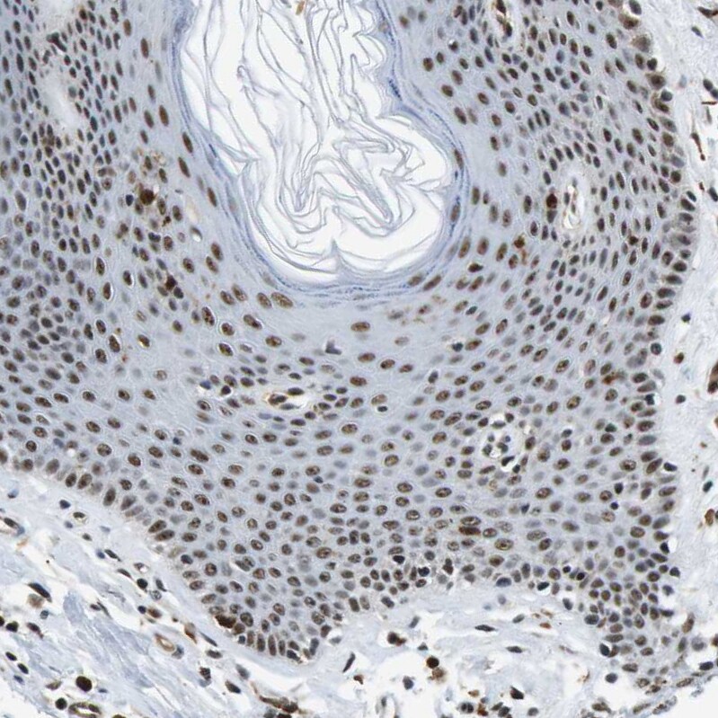 p400 Antibody - BSA Free Immunohistochemistry-Paraffin: p400 Antibody - BSA Free [NBP1-88230]