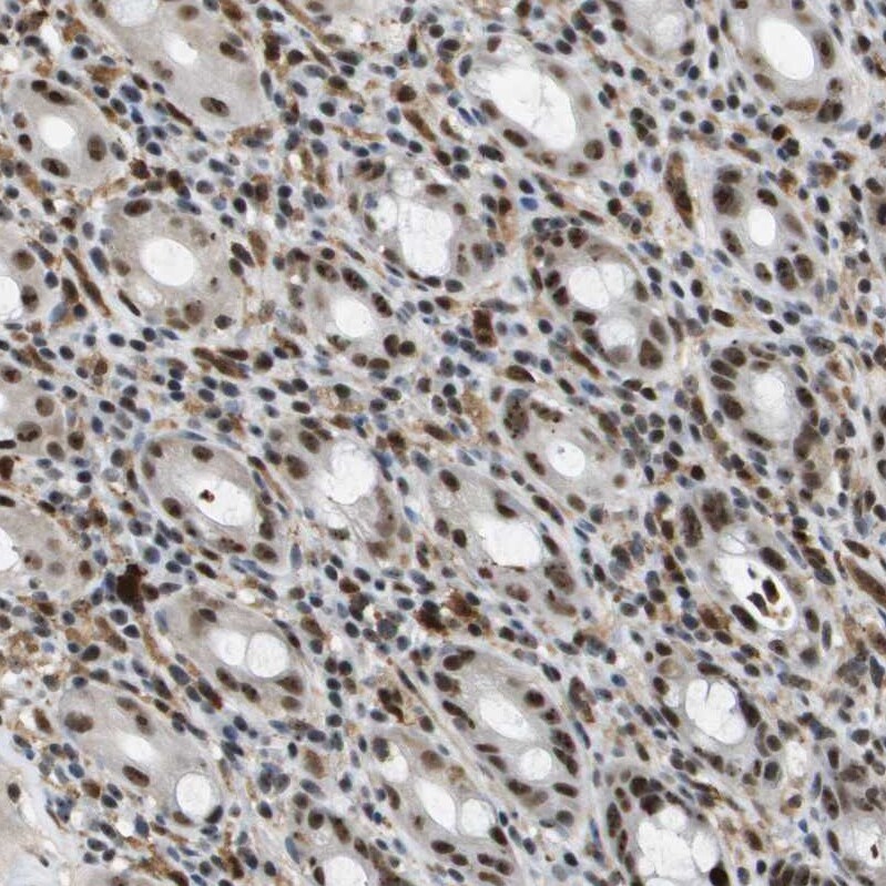 p400 Antibody - BSA Free Immunohistochemistry-Paraffin: p400 Antibody - BSA Free [NBP1-88230]