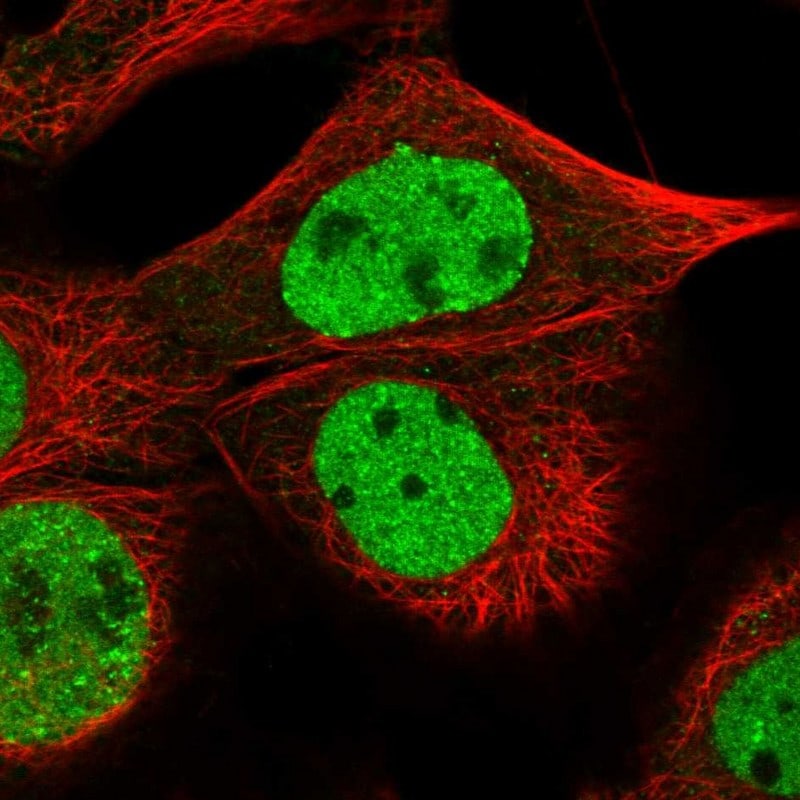 CHAF1B Antibody - BSA Free Immunocytochemistry/ Immunofluorescence: CHAF1B Antibody [NBP1-88235]
