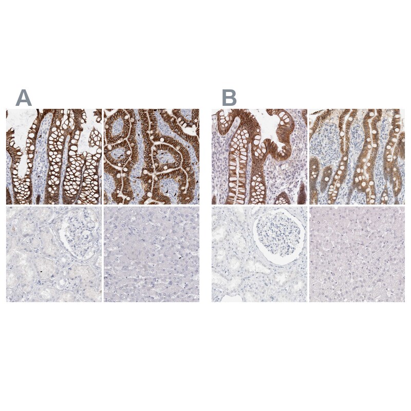 Cadherin-17 Antibody Immunohistochemistry-Paraffin: Cadherin-17 Antibody Antibody [NBP1-88237]