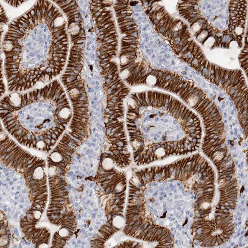 Cadherin-17 Antibody - BSA Free Immunohistochemistry-Paraffin: Cadherin-17 Antibody - BSA Free [NBP1-88237]