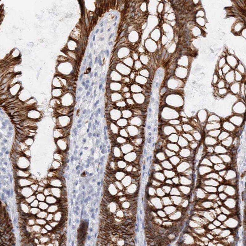 Cadherin-17 Antibody - BSA Free Immunohistochemistry-Paraffin: Cadherin-17 Antibody - BSA Free [NBP1-88237]