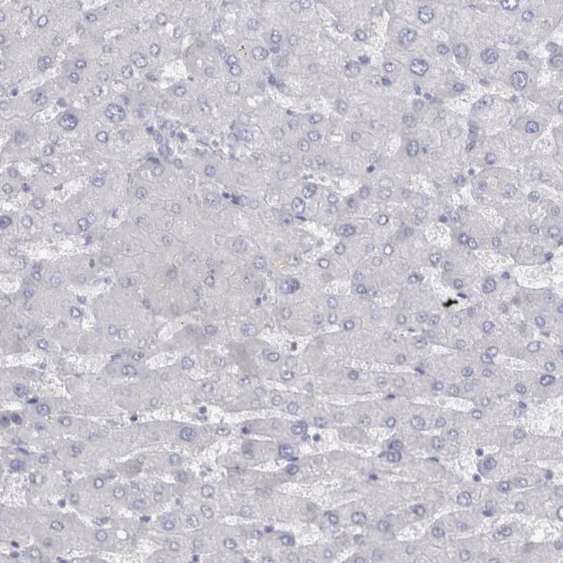 Cadherin-17 Antibody - BSA Free Immunohistochemistry-Paraffin: Cadherin-17 Antibody - BSA Free [NBP1-88237]