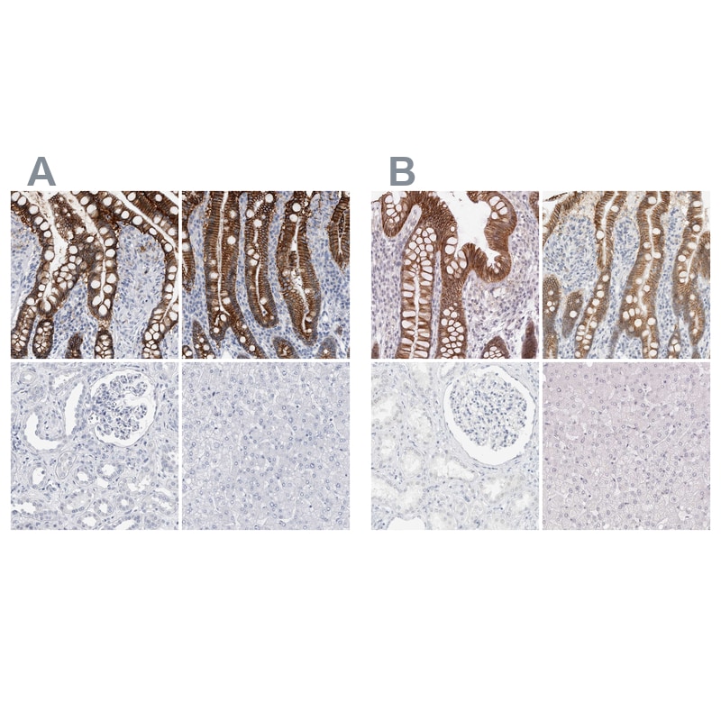 Cadherin-17 Antibody Immunohistochemistry-Paraffin: Cadherin-17 Antibody Antibody [NBP1-88238]