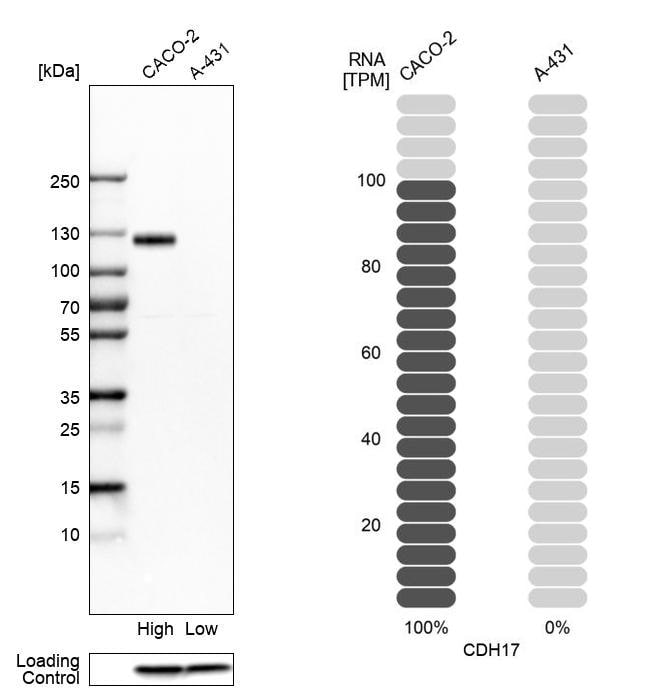 Cadherin-17 Antibody - BSA Free Western Blot: Cadherin-17 Antibody - BSA Free [NBP1-88238]