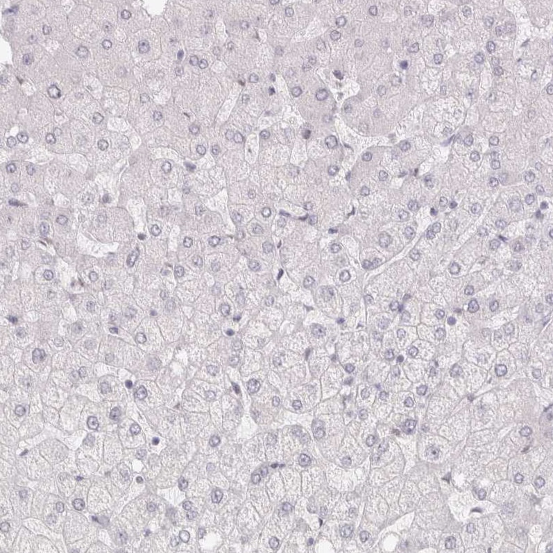 Cadherin-17 Antibody - BSA Free Immunohistochemistry-Paraffin: Cadherin-17 Antibody - BSA Free [NBP1-88239]
