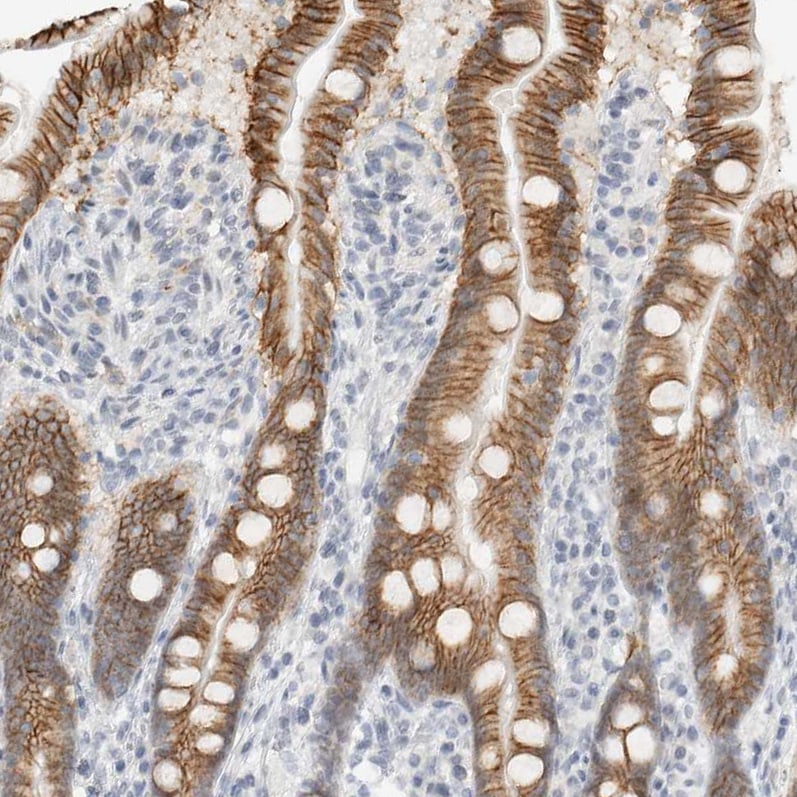 Cadherin-17 Antibody - BSA Free Immunohistochemistry-Paraffin: Cadherin-17 Antibody - BSA Free [NBP1-88239]