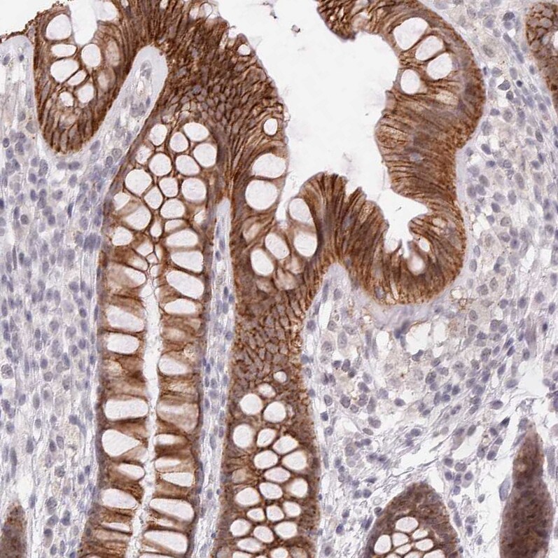 Cadherin-17 Antibody - BSA Free Immunohistochemistry-Paraffin: Cadherin-17 Antibody - BSA Free [NBP1-88239]