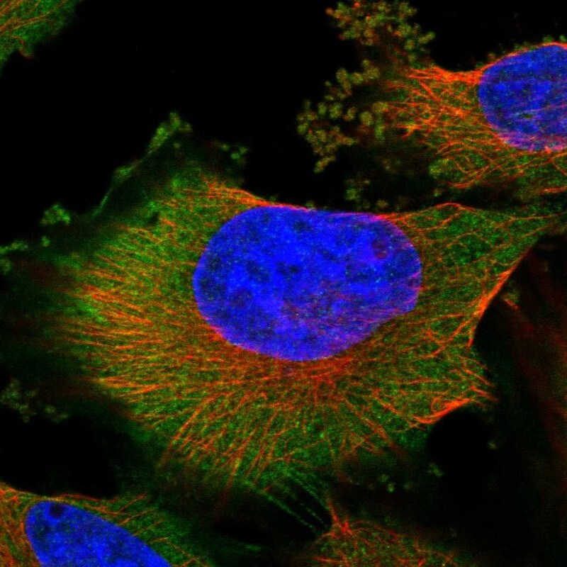 CGI 62 Antibody - BSA Free Immunocytochemistry/ Immunofluorescence: CGI 62 Antibody [NBP1-88246]